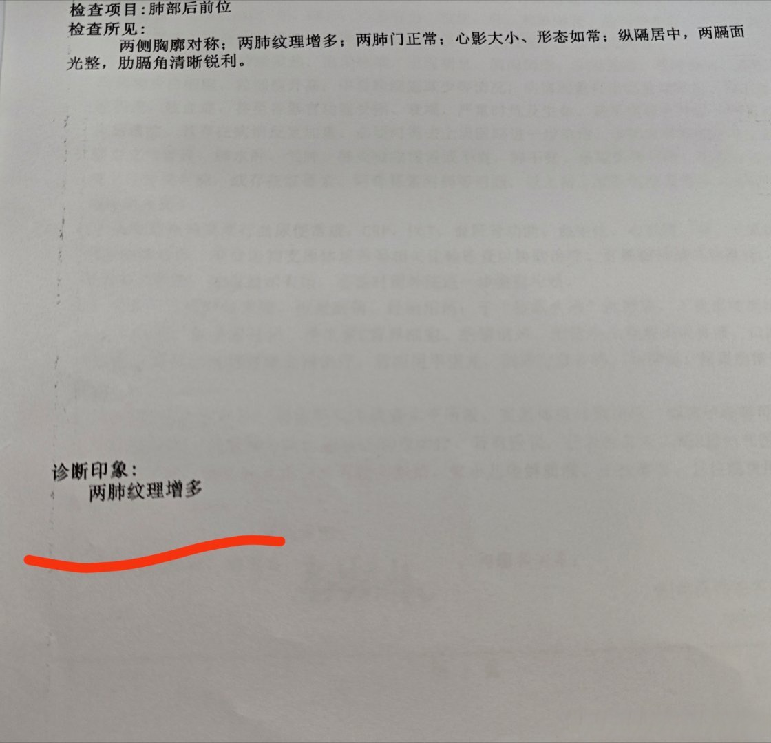 【青岛确诊病例是哪里的/青岛确诊患者】-第1张图片