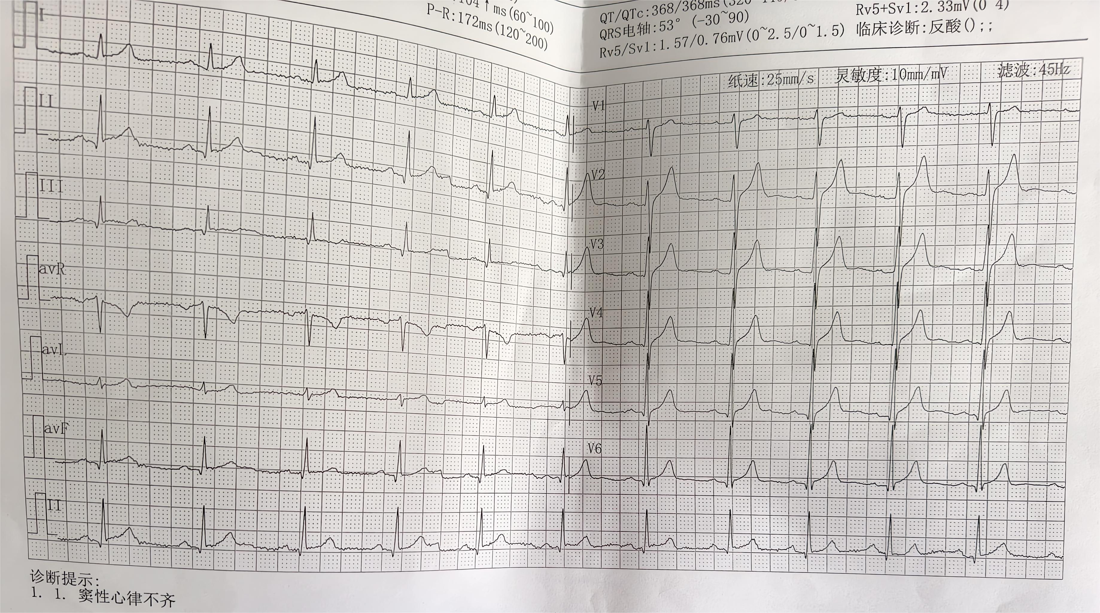 北京8个区已报告确诊病例.北京确诊病例都在哪个区-第2张图片