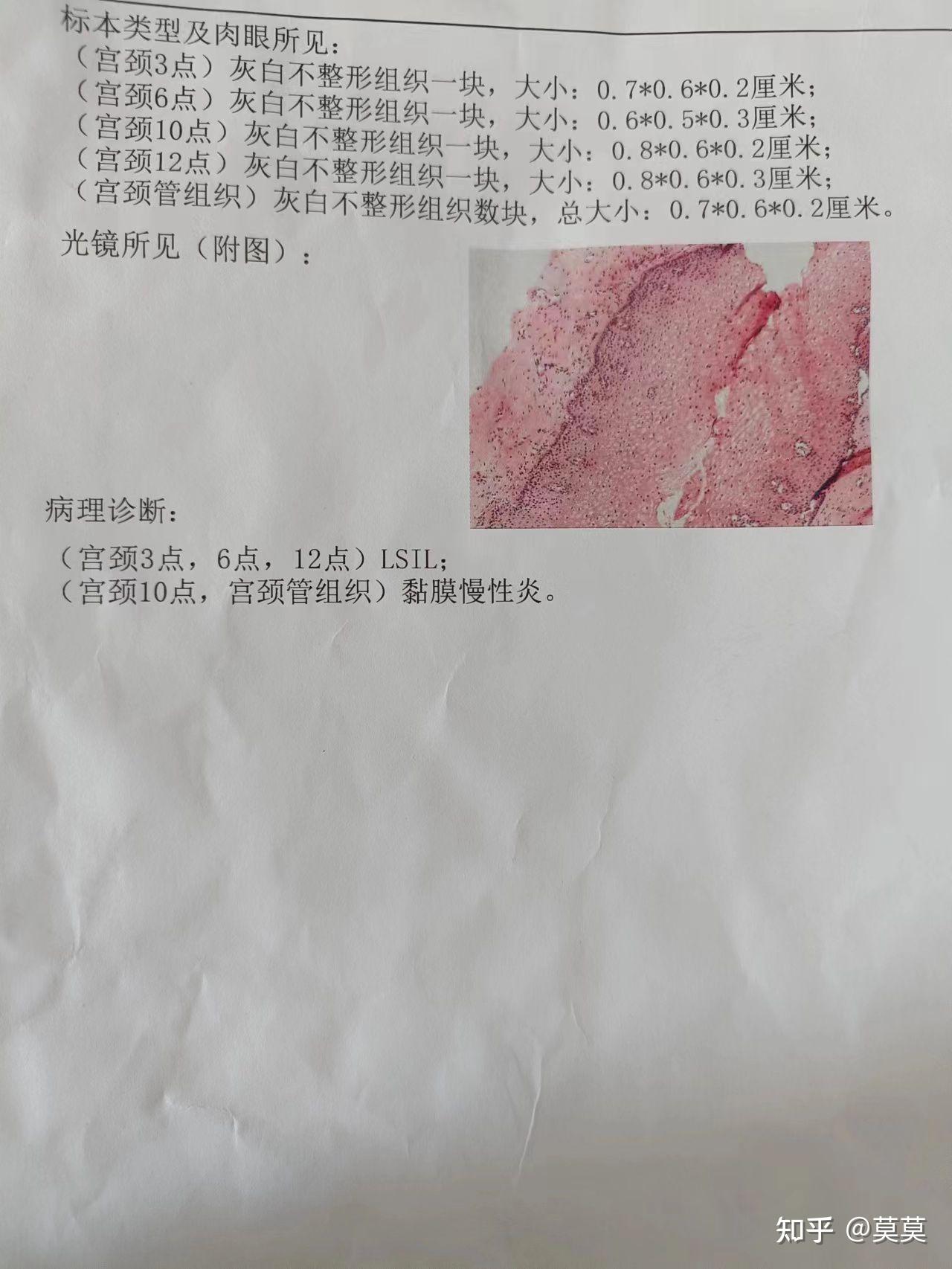 江苏江阴检出阳性感染者20人-江阴 病例-第1张图片