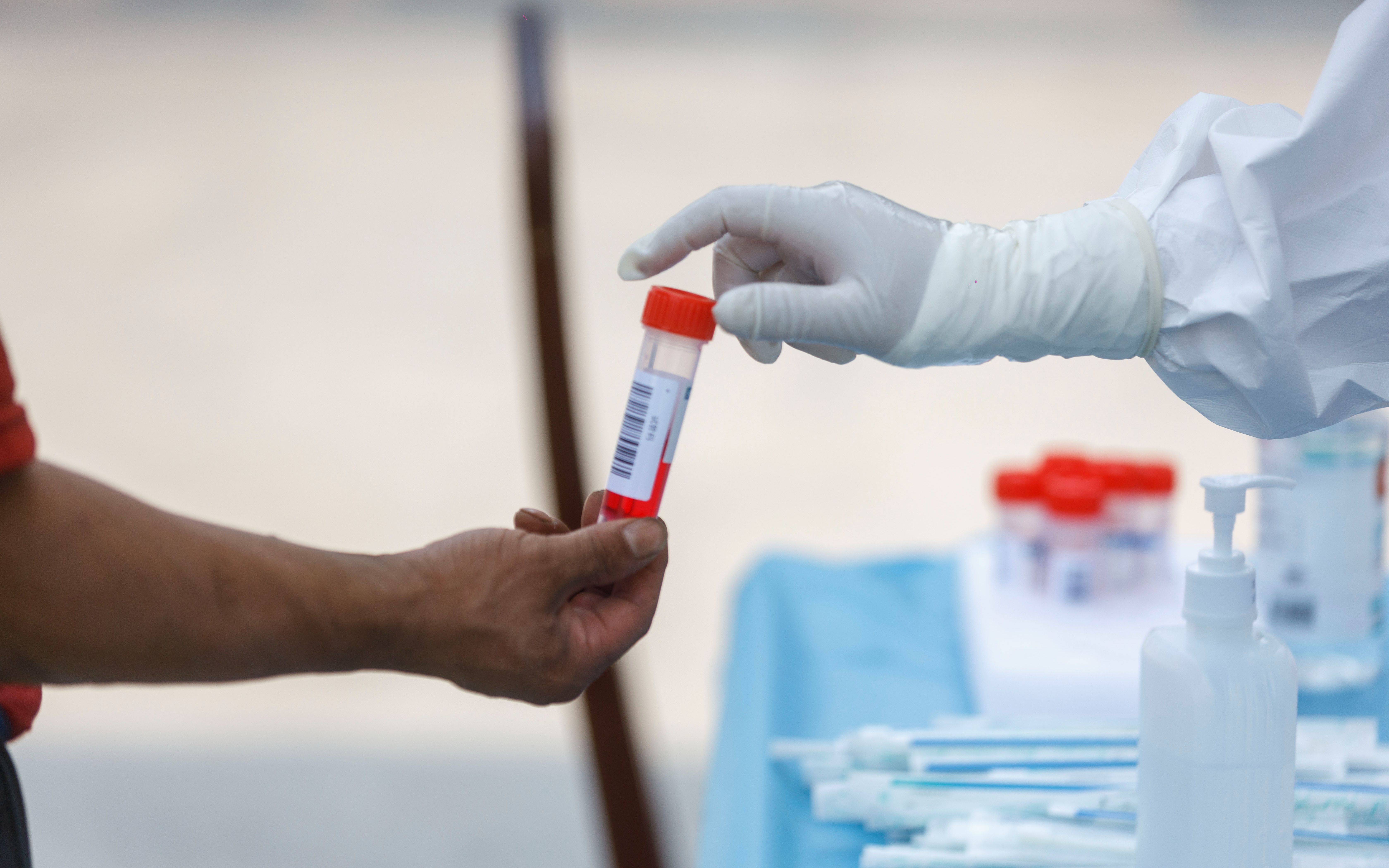 「31省新增3例确诊1例为本土病例」〃31省新增3例确诊1例为本土病例是哪里的-第2张图片