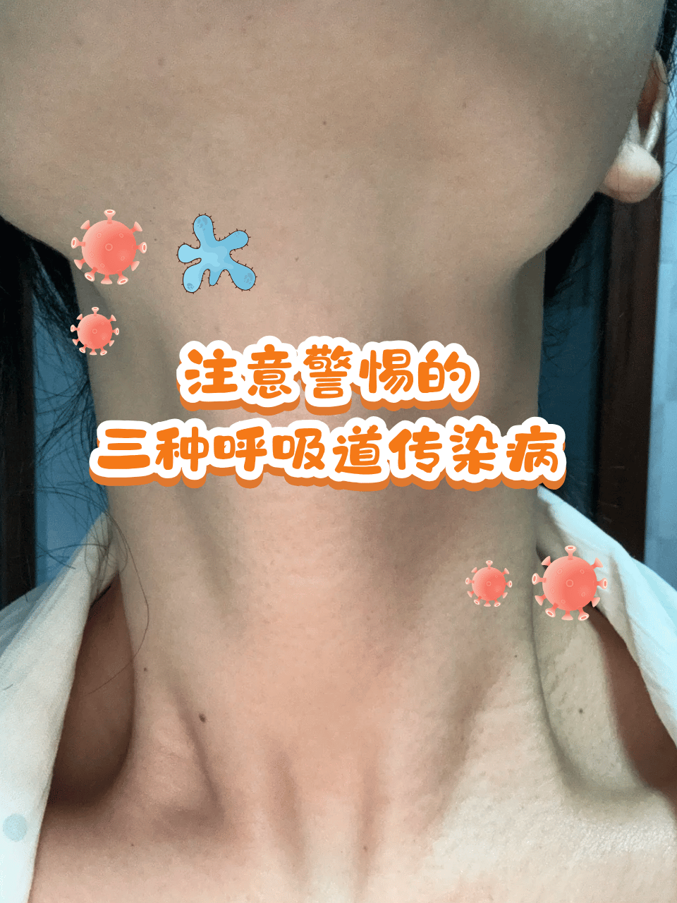 “最新新冠病毒	” 最新新冠病毒感染什么症状？-第2张图片