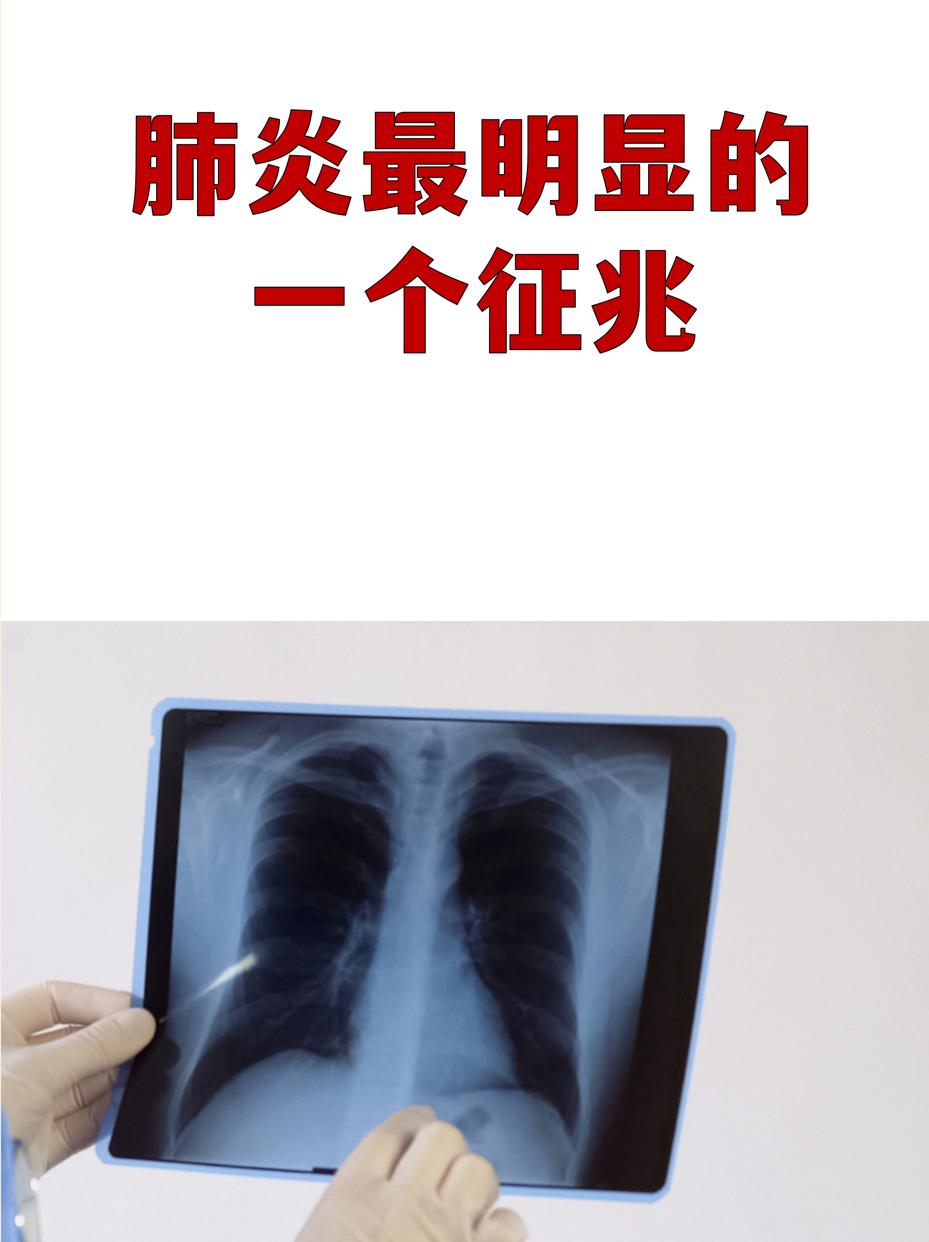 包含南京市江宁区新增23例阳性的词条-第1张图片