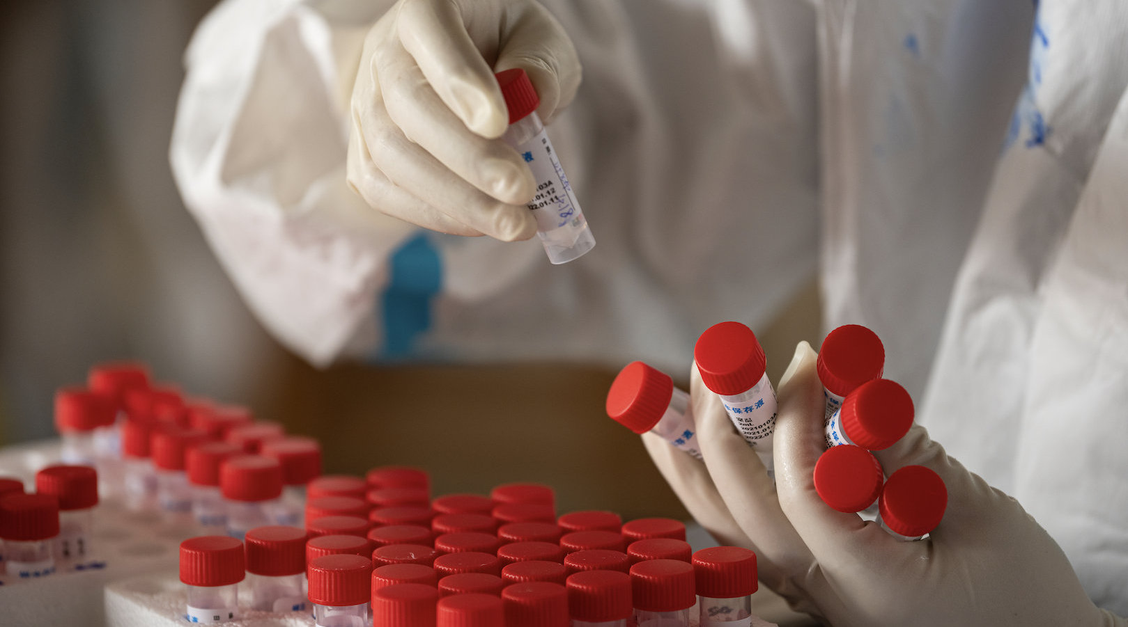 【北京67例感染者详情:含学生外卖员/北京某学校学生感染】-第1张图片