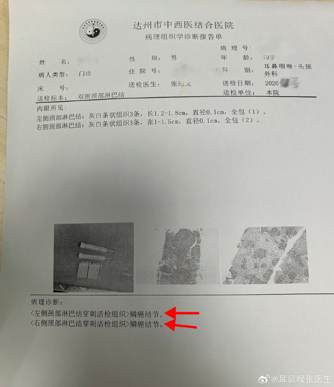「江苏连云港新增确诊4例」〃江苏连云港确诊病例-第3张图片